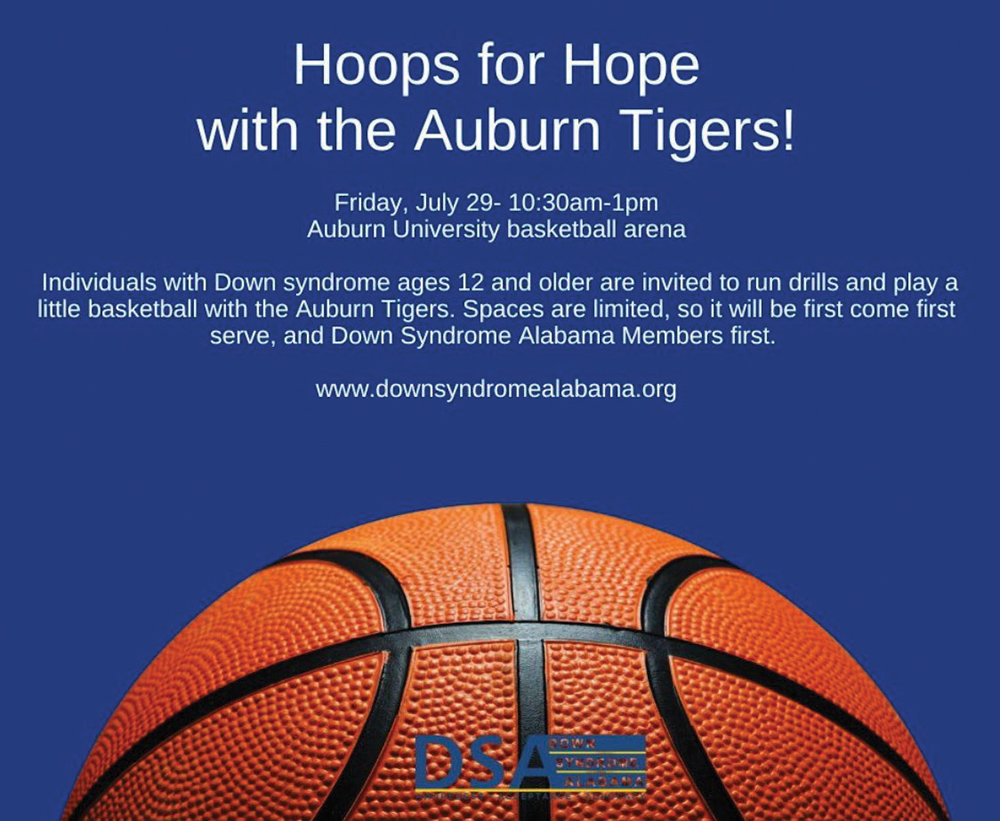 Auburn Aims to Hoop for Hope